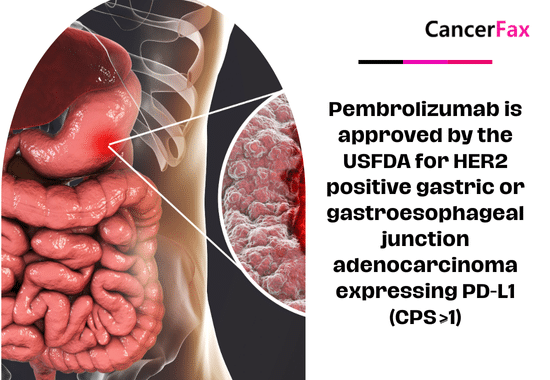 Pembrolizumab is approved by the USFDA for HER2 positive gastric or gastroesophageal junction adenocarcinoma expressing PD-L1 (CPS ≥1)